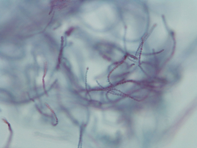 Anabaena Slides - Anabaena 09 400X